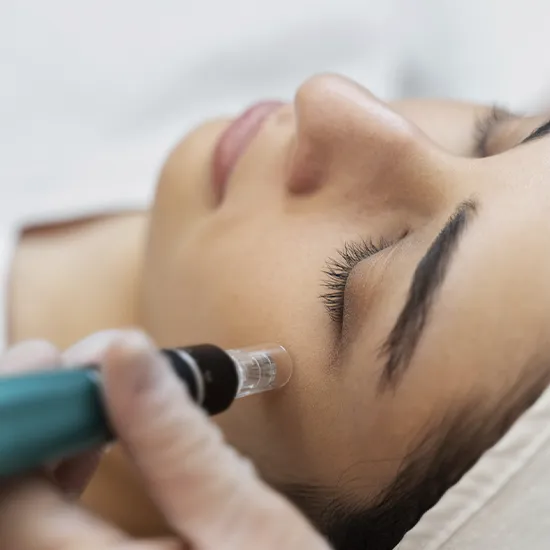 Dermapen MH Centro Médico Estético